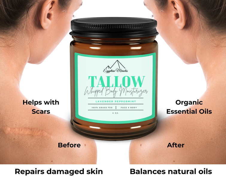 Tallow Revolution: What Is Egyptian Miracles Grass Fed Beef Tallow Whipped Body Moisturizer and Why Is It a Skincare Essential?